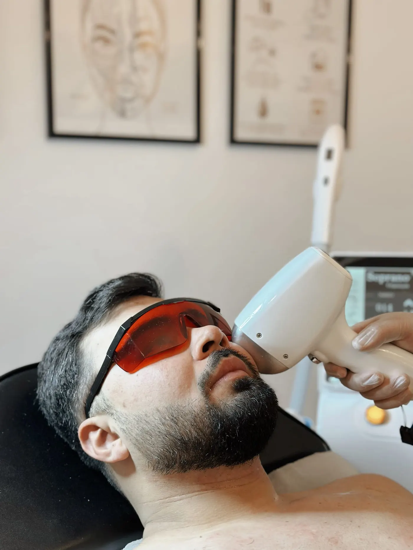 Laser ontharing behandeling Gent