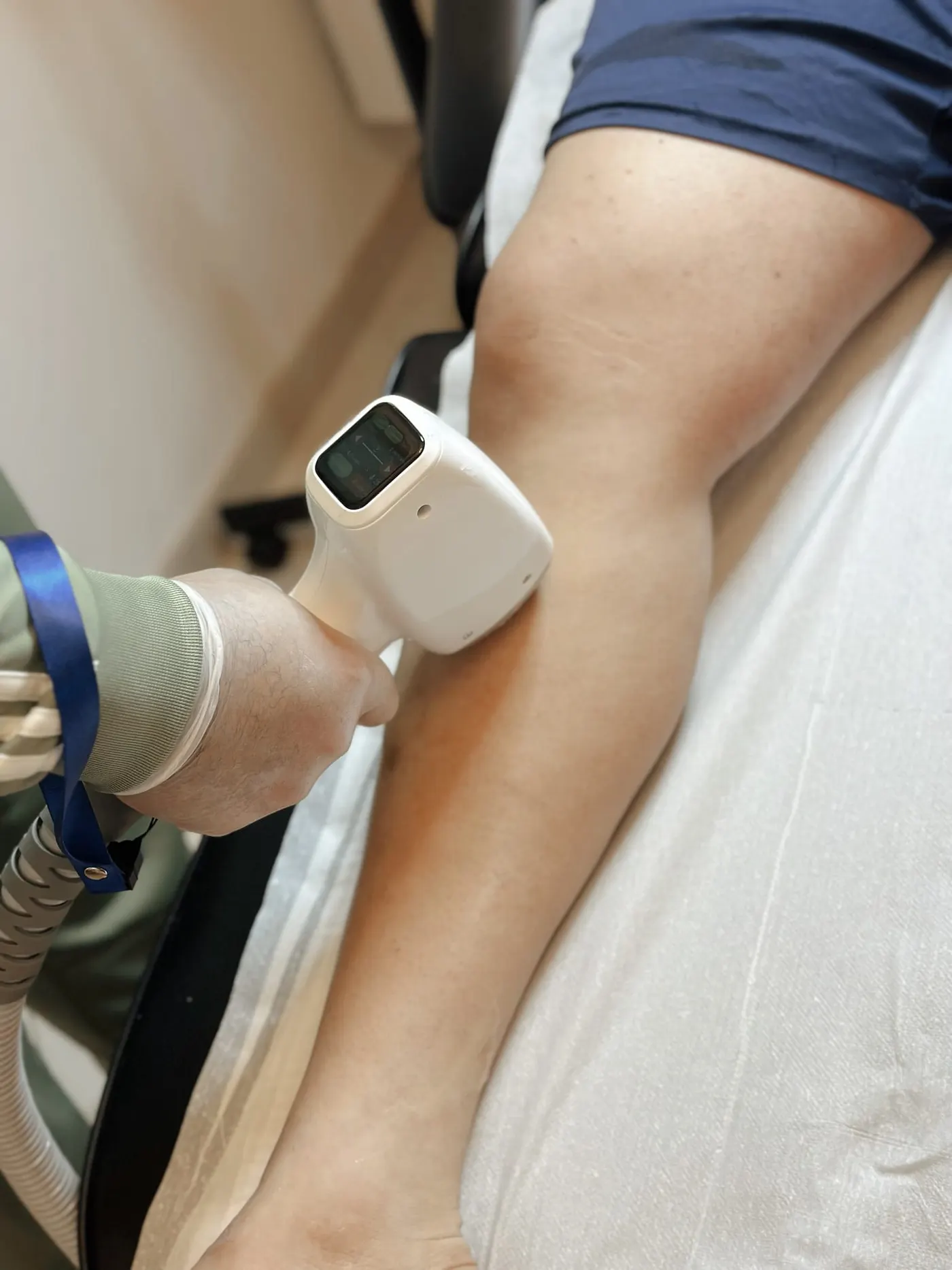 Laser ontharing benen Gent